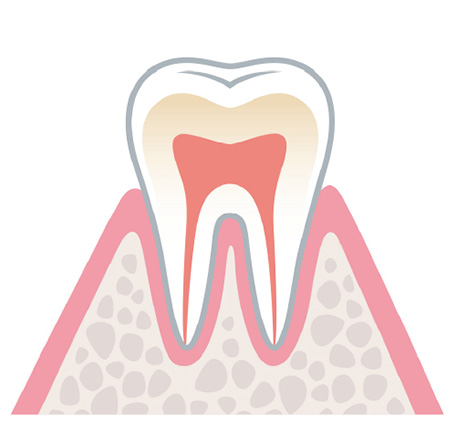 健康な状態の歯ぐき