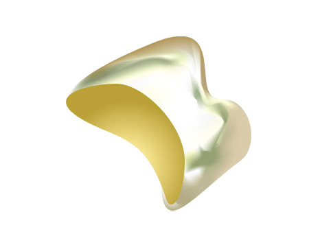 ゴールドクラウン