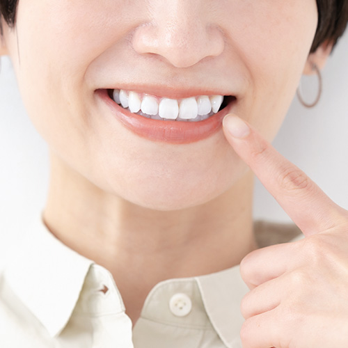 ホワイトニング